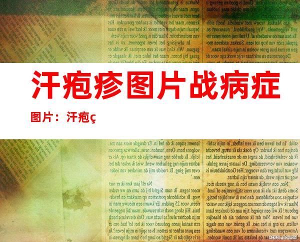 汗疱疹图片战病症图片：汗疱疹怎么惹起的能自愈吗