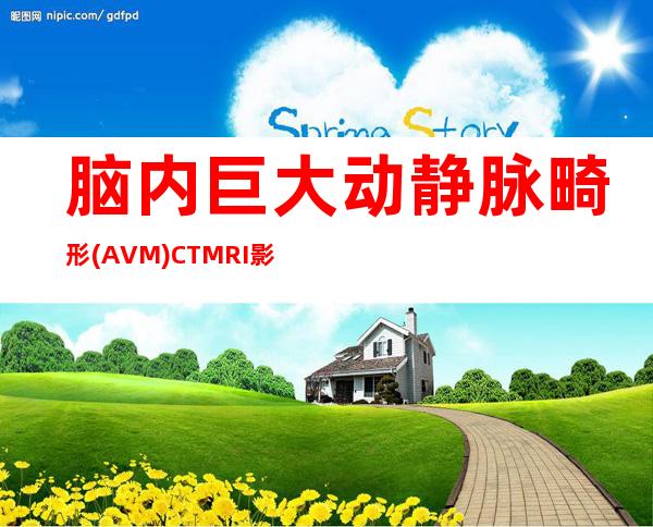 脑内巨大动静脉畸形(AVM)CT&MRI影像展示