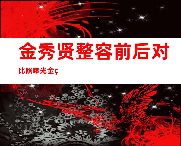 金秀贤整容前后对比照曝光金秀贤自认整容都整了哪些部位？