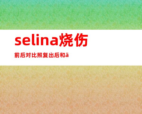 selina烧伤前后对比照 复出后和丈夫离婚了